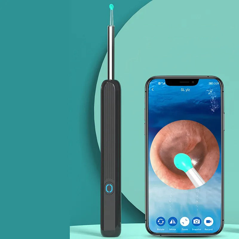 Nzmartys Ear Wax Removal Tool