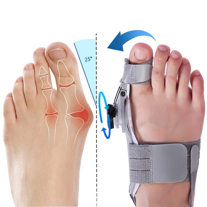 Nzmartys Bunion Fix Corrector